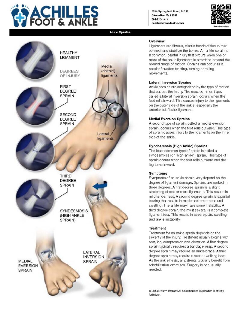 Ankle Sprain Educational Information