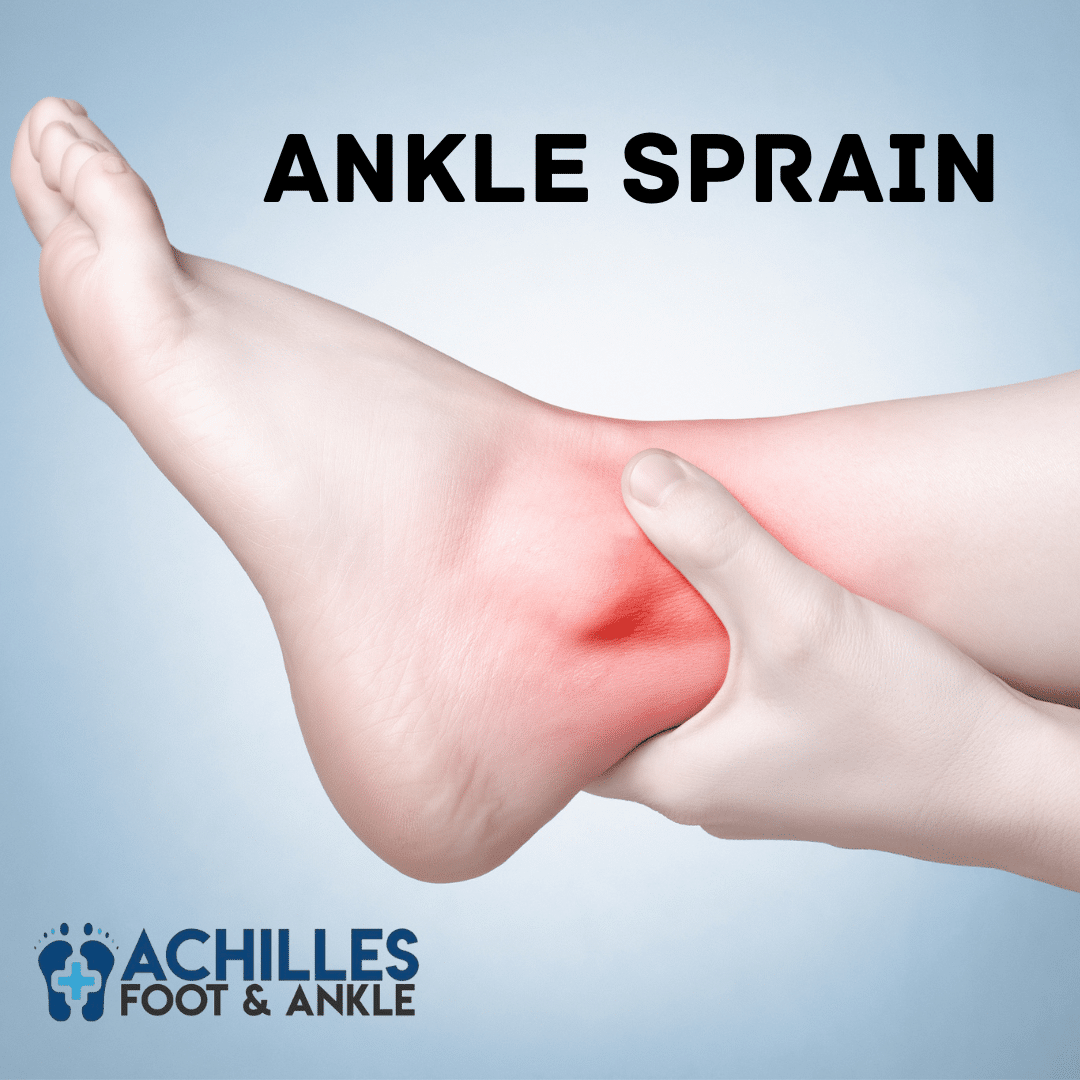 Ankle Sprain Educational Information