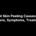 foot-skin-peeling-causes Foot Skin Peeling Causes: 10 Reasons, Symptoms, Treatments