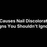 What Causes Nail Discoloration? 7 Signs You Shouldn't Ignore