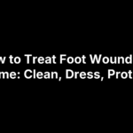 how-to-treat-foot-wounds How to Treat Foot Wounds at Home: Clean, Dress, Protect