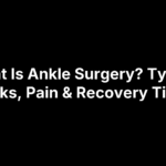 What Is Ankle Surgery? Types, Risks, Pain & Recovery Time