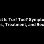 What Is Turf Toe? Symptoms, Grades, Treatment, and Recovery
