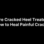 Severe Cracked Heel Treatment: How to Heal Painful Cracks