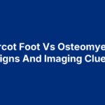 Charcot Foot Vs Osteomyelitis: Signs And Imaging Clues