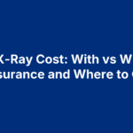 Foot X-Ray Cost: With vs Without Insurance and Where to Go