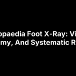 Radiopaedia Foot X-Ray: Views, Anatomy, And Systematic Review