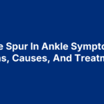Bone Spur In Ankle Symptoms: Signs, Causes, And Treatment