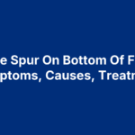 Bone Spur On Bottom Of Foot: Symptoms, Causes, Treatment