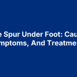 Bone Spur Under Foot: Causes, Symptoms, And Treatments