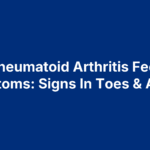 Rheumatoid Arthritis Feet Symptoms: Signs In Toes & Ankles