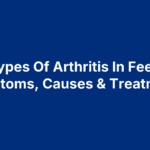 Types Of Arthritis In Feet: Symptoms, Causes & Treatments